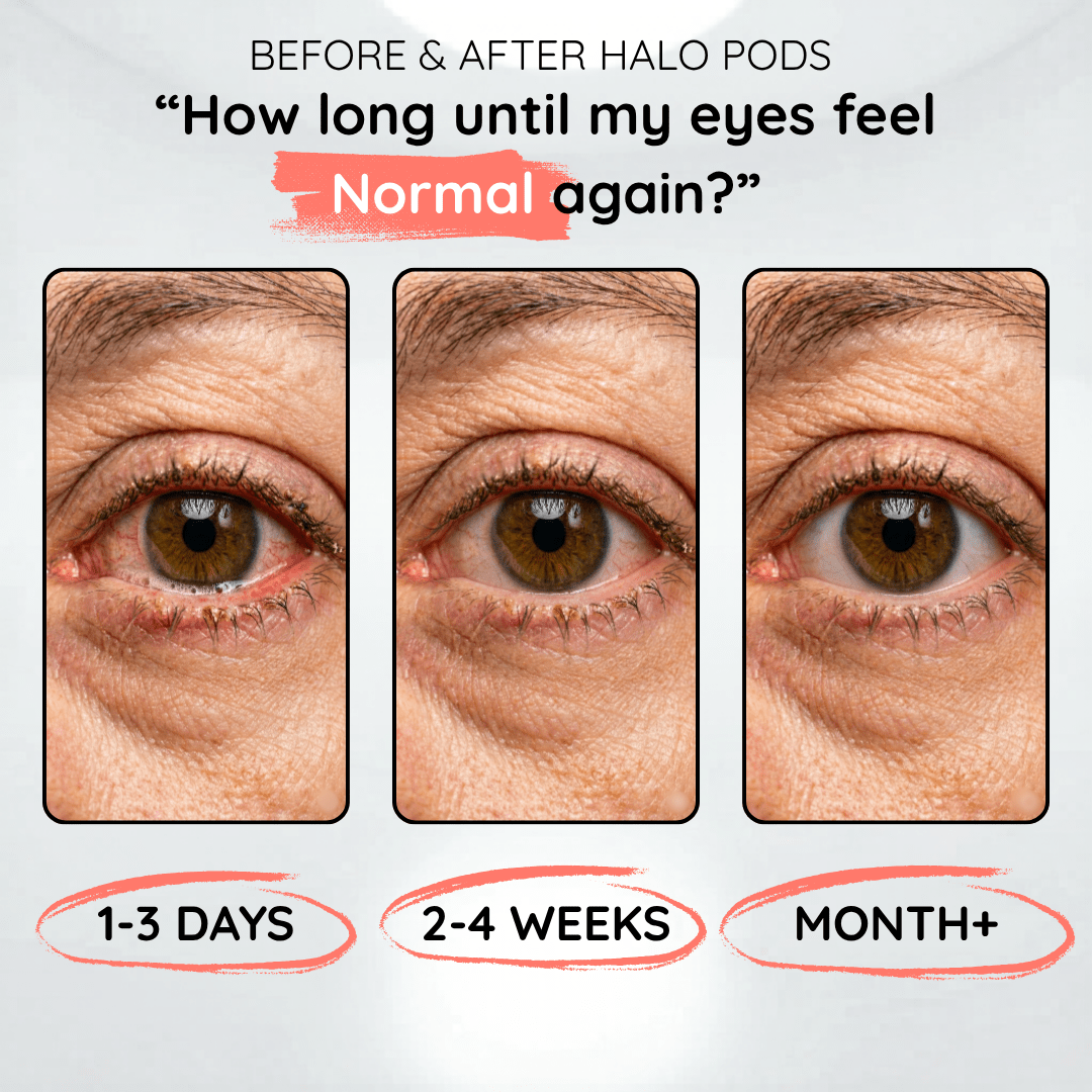 Halo Pods - HallunaCo